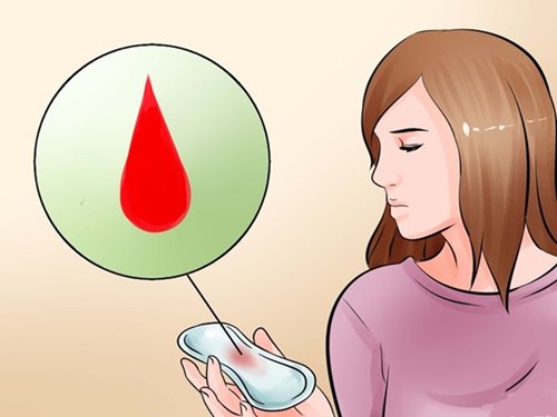 Xuất huyết tử cung bất thường là gì?