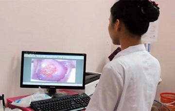 Các hạng mục kiểm tra bệnh viêm cổ tử cung