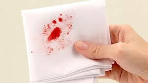 Đi tiểu ra máu ở nữ và cách chữa