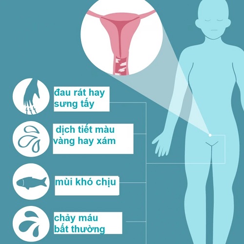 Nhận biết các triệu chứng viêm âm đạo ở nữ giới