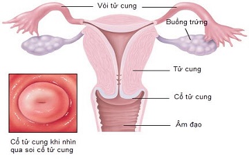 Nguyên nhân gây viêm cổ tử cung