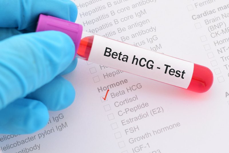 Địa chỉ xét nghiệm máu HCG uy tín tại Hà Nội