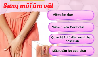 sung-moi-am-vat-trieu-chung-nho-he-luy-lon-neu-chu-quan
