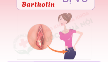viem-tuyen-bartholin-co-nguy-hiem-khong